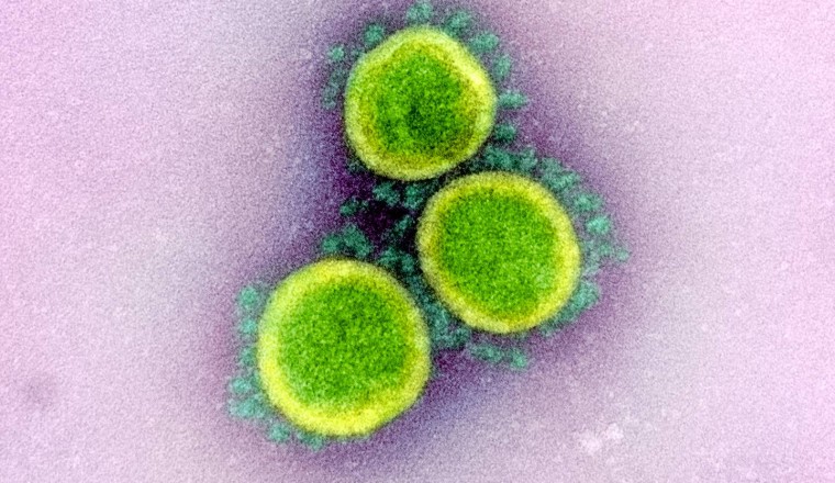 John Hopkins University: Q+A HOW LONG CAN THE VIRUS THAT CAUSES COVID-19 LIVE ON SURFACES?